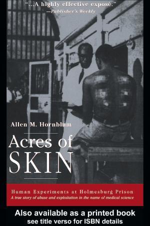 Allen M. Hornblum: Acres of Skin (1998)