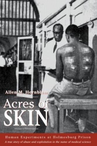 Allen M. Hornblum: Acres of Skin